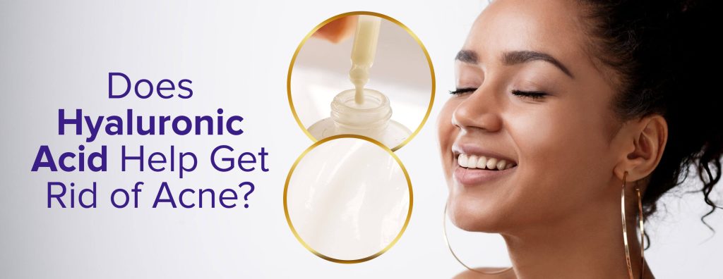 Does Hyaluronic Acid Help Get Rid of Acne? Here is a Complete Guide